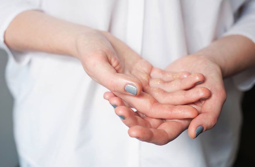 Chăm sóc đôi tay bằng kem dưỡng da tay Olive 3W Clinic, tại sao không?